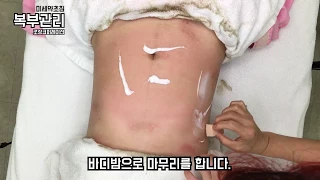 [임플란팅코스메틱] 마이크로니들 복부관리 영상