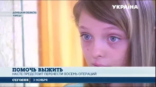 Более 10 пластических операций для 8-летней девочки