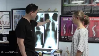 Former dancer experienced neuro tics for past 8-9 years -- FIXED Gonstead Chiropractic