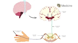 The Chronic Pain and Mental Health Connection