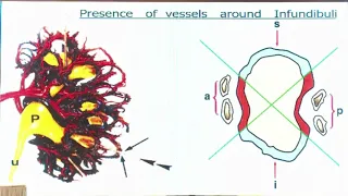 Basics of Renal Access in PCNL by DR SK PAL