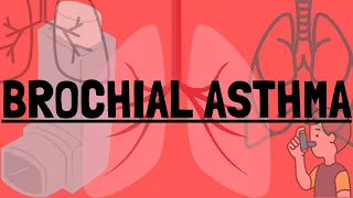 BRONCHIAL ASTHMA #Quick Discussion Series #Revision