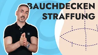 Dein Plastic Surgery Coach - Labbrige Bauchdecke? Alles über die Bauchdeckenstraffung.