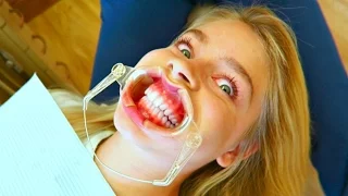 MARLA GETS HER BRACES ON!