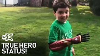 8-year-old boy gets Marvel-themed bionic arm