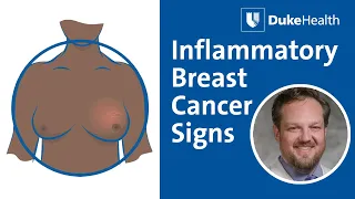 Inflammatory Breast Cancer Signs | Duke Health