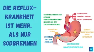 7 Faktoren zur Entstehung der Refluxkrankheit