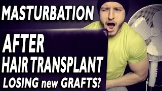 Will you lose grafts if you masturbate after hair transplant!?