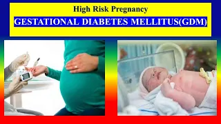 GESTATIONAL DIABETES MELLITUS (GDM) - define , causes, symptoms, effects, management - OBG