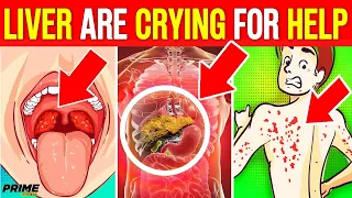 10 Signs Your LIVER Are Crying For Help