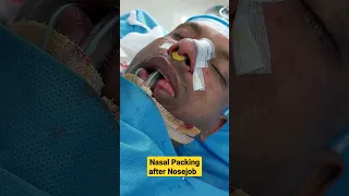 Nosejob Surgery final Nasal Packing #rhinoplasty #nosejob #shorts