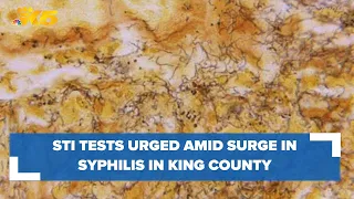 Public Health officials urge STI tests amid rise in syphilis cases in King County