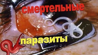 СМЕРТЕЛЬНЫЕ ПАРАЗИТЫ В НАШЕМ ОРГАНИЗМЕ