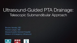 TelescopicSubmandibularApproach PTA