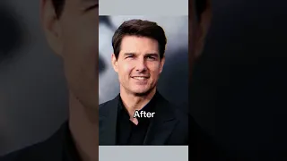 Thomas Cruise Before and after