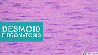 Desmoid Fibromatosis (Desmoid Tumor) - Explained by a Soft Tissue Pathologist