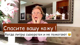 Почему кожа сохнет ? Рассказываю о причинах и их ПРОСТОМ устранении 👍