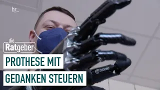 Leben mit Handprothese | Die Ratgeber