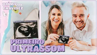 OUVIMOS O CORAÇÃO DO NOSSO BABY + PRIMEIRO ULTRASSOM