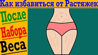 Как избавиться от растяжек на коже?!