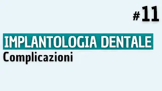 Implantologia Dentale - Complicazioni