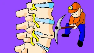 How to Stop Degenerative Joint Disease Pain in Less than 4 minutes!