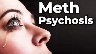 What's Meth Psychosis? | Complete Methamphetamine Psychosis overview