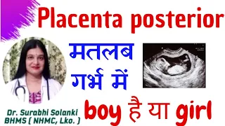 Placenta posterior means boy or girl |  Placenta anterior means boy or girl