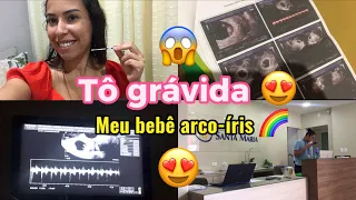 TÔ GRÁVIDA 😍MEU BEBÊ ARCO-ÍRIS 🌈 NÓS SONHAMOS E DEUS REALIZOU 🙏🏻😍@lardadinha8