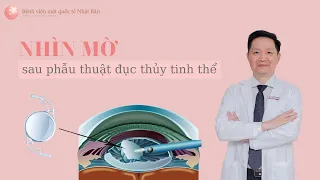 Vì sao nhìn mờ sau phẫu thuật đục thủy tinh thể | Bệnh viện mắt quốc tế Nhật Bản 32 Phó Đức Chính