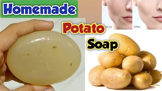 How to make Skin whitening potato soap at home | diy potato soap | Homemade potato soap