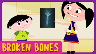 🟠 BROKEN BONES - Full Episode l Earth To Luna!