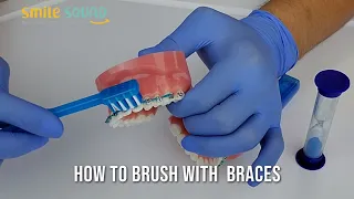 How to Brush with Braces Tips and Tricks