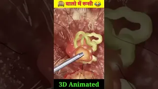 3d Hair Dandruff Animated video @sn Pharmacy