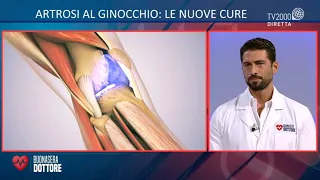 Curare l'artrosi al ginocchio senza l'intervento chirurgico