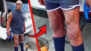 WTF Happened to Ronnie Coleman's Legs?