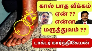 foot swelling treatment in tamil | dr karthikeyan-diabetes | கால் வீக்கம் எதனால் ஏற்படுகிறது