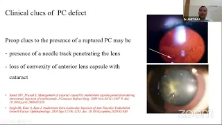 AIOC2021-GP29-Topic-Dr.Amit Raj-Phaco in post intravitreal injection cataract