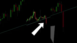 Head and Shoulders Pattern in Technical Analysis 🔴 Bearish Chart Pattern 🔴 Reversal Price Pattern