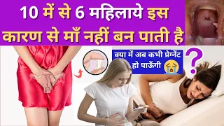 महिला में ऐसे रंग का डिस्चार्ज हो तो माँ नहीं बन पाती ??🤔 WHITE DISCHARGE & PERIODS - कारण और इलाज