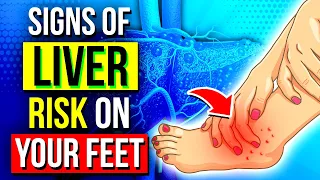 9 Secrets Your Feet Can Uncover About Your Liver Health
