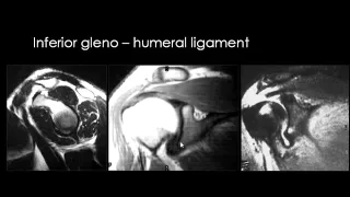 Dr Mamdouh Mahfouz MSK imaging Shoulder joint part 1   YouTube