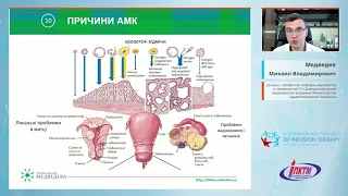 Аномальные маточные кровотечения: роль офисной гистероскопии (Медведев М.В.)