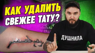 Как удалить лазером свежую татуировку? | Что делать, если вам набили плохую тату?