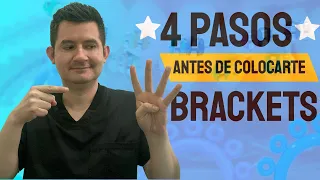 Como Ponerse Brackets | 4 Pasos Previos Antes de Colocarte Brackets