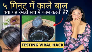 5 मिनट में काले बाल? Testing Viral Hair Dye Hack | Instant Homemade Kalonji Hair Dye