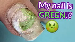 She Used Nail Glue And THIS is What Happened 🤢  | Melodysusie E-file Review