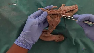 Pelvis-4: Urinary bladder & Urethra