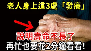 老人如果身上這3處「發癢」，說明壽命可能已經不長了！如果你一個都不占，活到100歲沒問題！【中老年講堂】