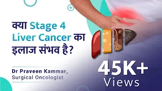 Stage 4 Liver Cancer का इलाज ? | Stage 4 Liver cancer | Liver Cancer | Dr Praveen Kammar